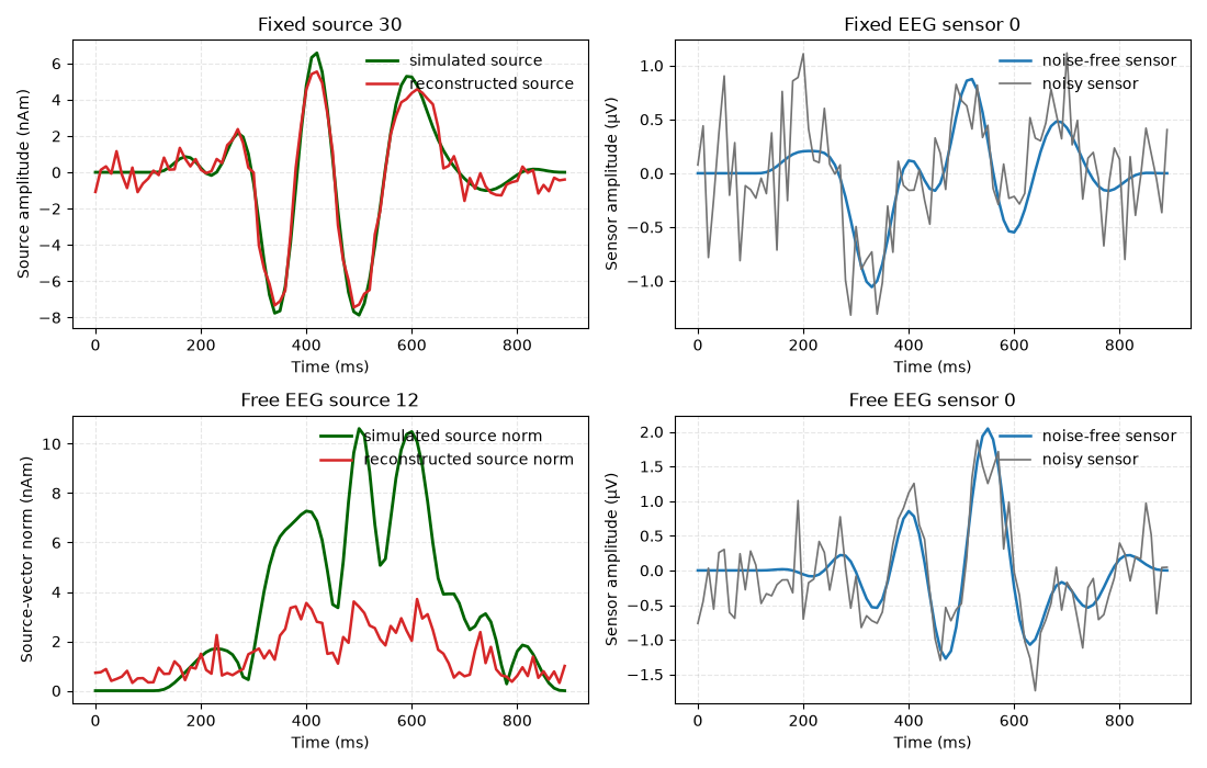 Fixed source 30, Fixed EEG sensor 0, Free EEG source 12, Free EEG sensor 0